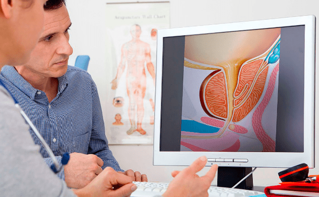 Prostatitis diagnosis